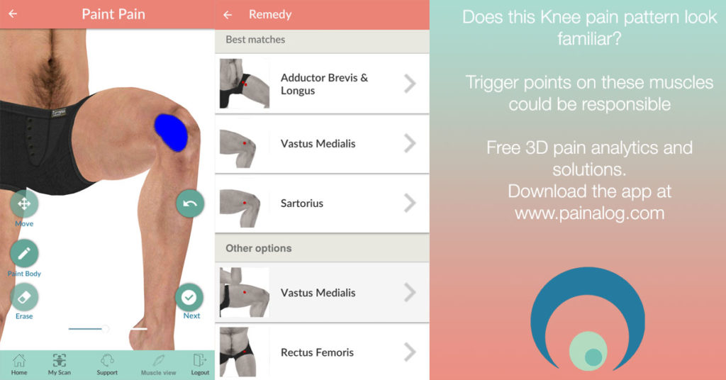 Pain on the inside of the knee: Causes and Solution – Painalog